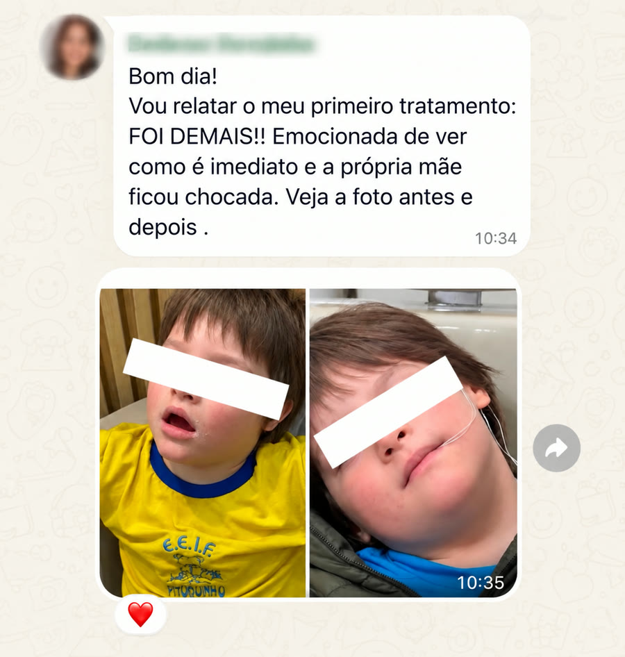 Print de depoimento com foto antes e depois do tratamento